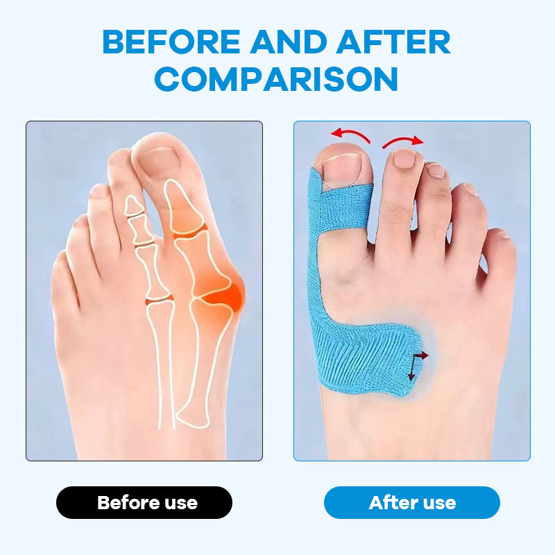 ✨Käytä kaikkia suosikkikenkiäsi – ilman hallux valgus‑kipua! 👠💃